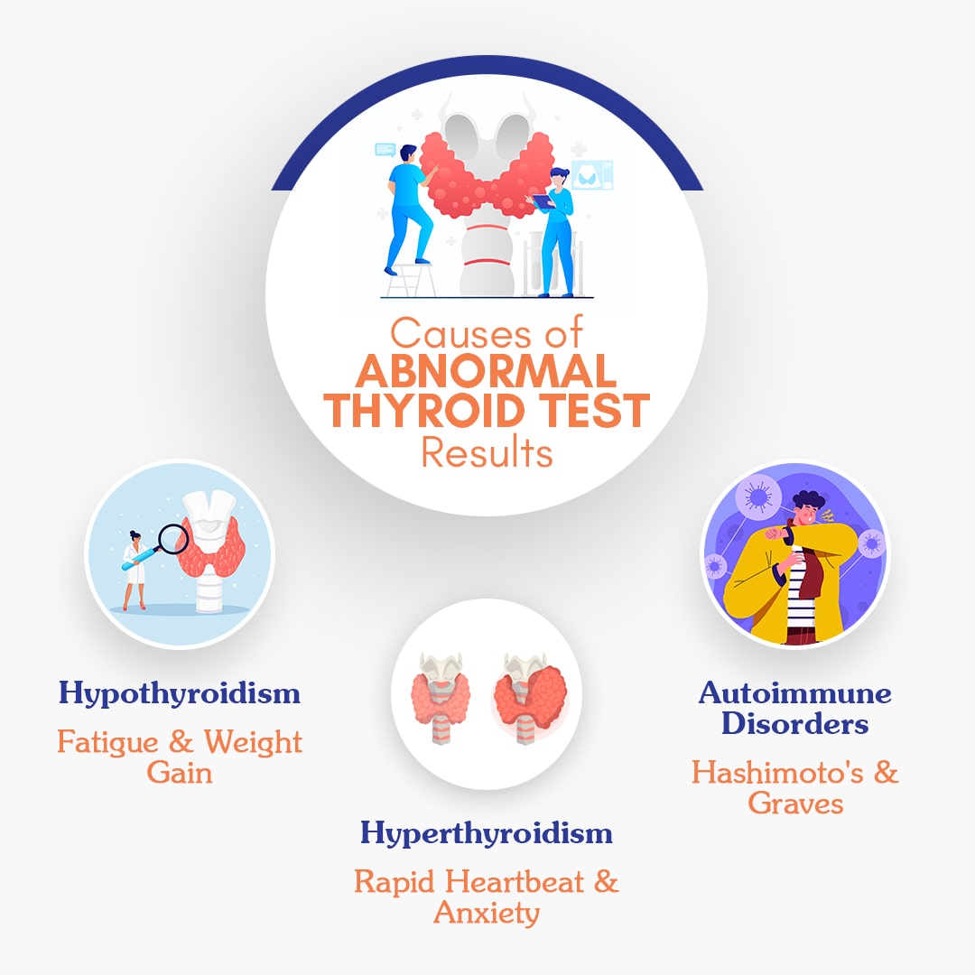 Possible causes of abnormal thyroid function test results 